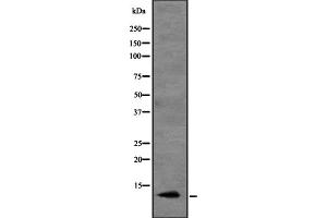 Western blot analysis of CCL20 expression in HEK293 cells ,The lane on the left is treated with the antigen-specific peptide.