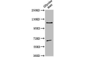Western Blot Positive WB detected in: Glycine max leaf tissue All lanes: CESA4 antibody at 1:500 Secondary Goat polyclonal to rabbit IgG at 1/50000 dilution Predicted band size: 120 kDa Observed band size: 120 kDa (CESA4 antibody  (Catalytic Subunit 4))