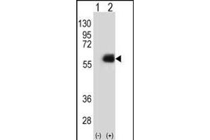 NMT2 Antikörper  (N-Term)