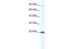 MCM4 antibody used at 5 ug/ml to detect target protein.