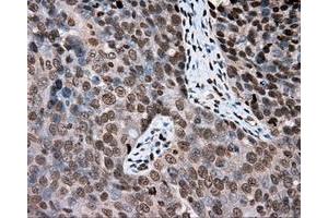 Immunohistochemical staining of paraffin-embedded Kidney tissue using anti-DAPK2 mouse monoclonal antibody. (DAPK2 antibody)