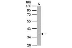 Image no. 1 for anti-NudE Neurodevelopment Protein 1 (NDE1) (AA 1-203) antibody (ABIN1499654) (NudE Neurodevelopment Protein 1 (NDE1) (AA 1-203) antibody)