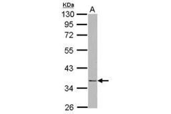 NudE Neurodevelopment Protein 1 (NDE1) (AA 1-203) antibody