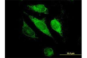 Immunofluorescence of purified MaxPab antibody to GSTK1 on HeLa cell. (GSTK1 antibody  (AA 1-226))