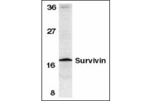 Western blot analysis of survivin in mouse spleen tissue lysate with this product at 1 μg/ml.