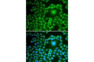 Immunofluorescence analysis of U2OS cell using PPP1CB antibody. (PPP1CB antibody)