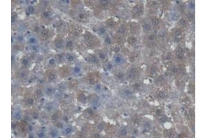 DAB staining on IHC-P; Samples: Rat Liver Tissue (AGXT antibody  (AA 182-371))