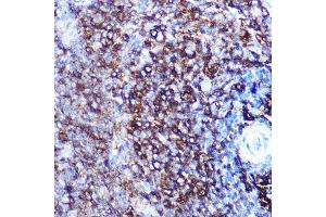 Immunohistochemistry of paraffin-embedded rat spleen using HLA-DQ Rabbit mAb (1252) at dilution of 1:100 (40x lens). (HLA-DQA1 antibody)