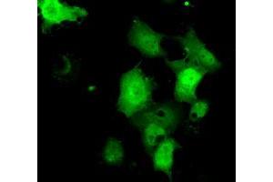 Anti-C21orf59 mouse monoclonal antibody (ABIN2453835) immunofluorescent staining of COS7 cells transiently transfected by pCMV6-ENTRY C21orf59 (RC200169). (C21orf59 antibody)