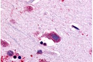 Anti-NTSR1 antibody  ABIN1049156 IHC staining of human brain, neurons and glia.