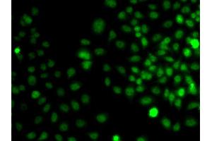 Immunofluorescence analysis of A549 cell using TRPS1 antibody.