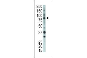 Antibody is used in Western blot to detect BMX in mouse heart tissue lysate. (BMX antibody  (AA 212-242))
