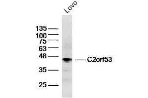 Lovo lysates probed with C2orf53 Polyclonal Antibody, Unconjugated  at 1:300 dilution and 4˚C overnight incubation. (PRR30 antibody  (AA 331-412))