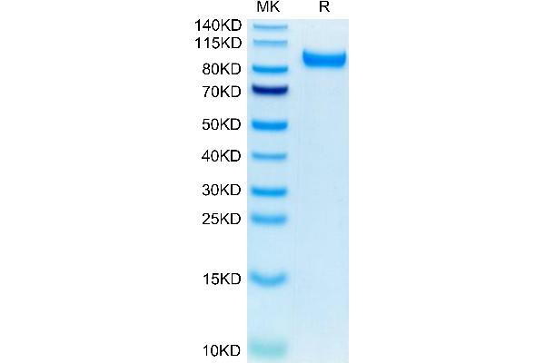 HGFA Protein (AA 35-653) (His tag)