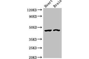 Western Blot Positive WB detected in: Rat heart tissue, Mouse brain tissue All lanes: CTH antibody at 4 μg/mL Secondary Goat polyclonal to rabbit IgG at 1/50000 dilution Predicted band size: 45, 40, 42 kDa Observed band size: 45 kDa (CTH antibody  (AA 1-70))