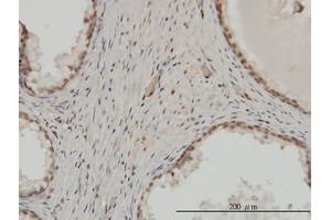 Image no. 1 for anti-Zinc Finger Protein 202 (ZNF202) (AA 301-401) antibody (ABIN599015) (ZNF202 antibody  (AA 301-401))