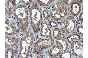 Image no. 2 for anti-Parvin, alpha (PARVA) antibody (ABIN1496442) (Parvin alpha antibody)