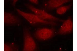 Immunofluorescence staining of methanol-fixed HeLa cells using c-Abl (phospho-Tyr412) antibody. (ABL1 antibody  (pTyr412))