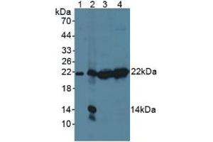 Figure. (PSMB9 antibody  (AA 22-219))