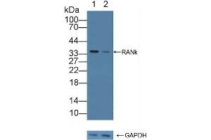 Western Blotting (WB) image for anti-Tumor Necrosis Factor Receptor Superfamily, Member 11a, NFKB Activator (TNFRSF11A) (AA 330-615) antibody (ABIN7434629)