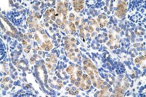 Image no. 1 for anti-Aldehyde Dehydrogenase 3 Family, Member A2 (ALDH3A2) (AA 351-400) antibody (ABIN6736668) (ALDH3A2 antibody  (AA 351-400))
