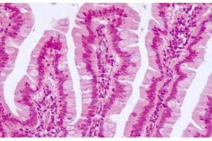 Anti-TCF7L2 antibody IHC of human small intestine. (TCF7L2 antibody  (N-Term))