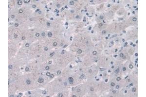 Detection of FABP1 in Human Liver Tissue using Monoclonal Antibody to Fatty Acid Binding Protein 1 (FABP1) (FABP1 antibody  (AA 2-127))