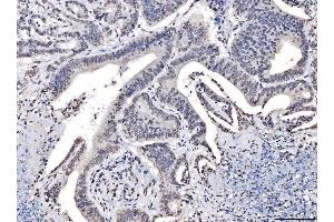 IHC analysis of TPR using anti-TPR antibody (ABIN7603243).