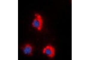 Immunofluorescent analysis of ZAP70 (pY319) staining in HeLa cells.