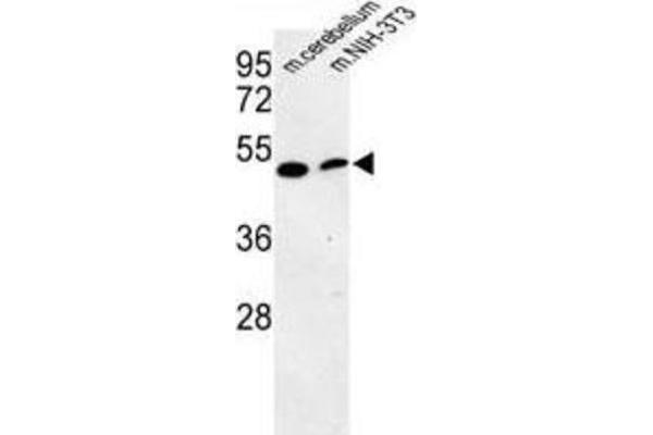 PISD antibody