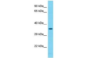 Host: Rabbit Target Name: NDUFAF7 Sample Type: 293T Whole Cell lysates Antibody Dilution: 1. (NDUFAF7 antibody  (C-Term))