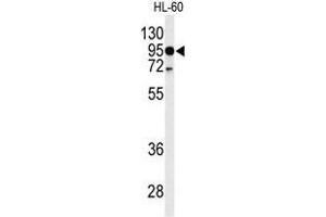 Western blot analysis of TLR4 Antibody (Center) in HL-60 cell line lysates (35 µg/lane).