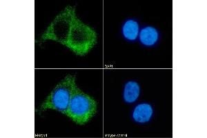 Immunofluorescence staining of fixed A431 cells with anti-Beta 2 adrenergic receptor antibody R11/E1. (Recombinant beta 2 Adrenergic Receptor antibody)