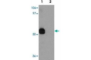 Western blot analysis of SPTLC2 in NIH/3T3 cell lysate with SPTLC2 polyclonal antibody  at 1 ug/mL in (1) the absence and (2) the presence of blocking peptide. (SPTLC2 antibody  (C-Term))