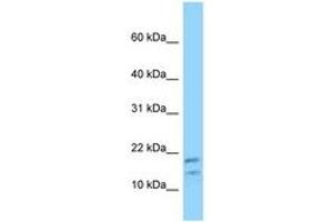 Image no. 1 for anti-Diazepam Binding Inhibitor (DBI) (N-Term) antibody (ABIN6748198) (Diazepam Binding Inhibitor antibody  (N-Term))