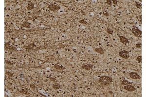 ABIN6279449 at 1/100 staining Rat brain tissue by IHC-P. (Gon-4-Like antibody  (N-Term))