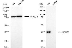 Western blotting analysis using HDHD5 antibody (ABIN7798836).