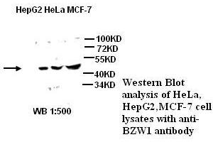 Image no. 2 for anti-Basic Leucine Zipper and W2 Domains 1 (BZW1) antibody (ABIN790909)