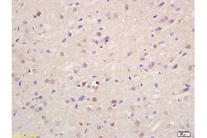 Formalin-fixed and paraffin embedded rat brain labeled with Rabbit Anti Exportin-2 Polyclonal Antibody, Unconjugated (ABIN737331) at 1:200 followed by conjugation to the secondary antibody and DAB staining (Exportin 2 antibody  (AA 901-971))
