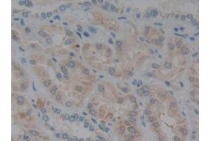 Immunohistochemistry (IHC) image for anti-Glutathione Peroxidase 1 (GPX1) (AA 50-203) antibody (ABIN7431530)