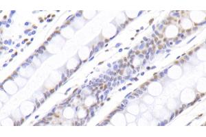 Immunohistochemistry (IHC) image for anti-Nucleophosmin (Nucleolar phosphoprotein B23, Numatrin) (NPM1) (AA 20-154) antibody (ABIN7435076)