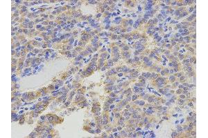 Immunohistochemistry (IHC) image for anti-5-Aminoimidazole-4-Carboxamide Ribonucleotide Formyltransferase/IMP Cyclohydrolase (ATIC) antibody (ABIN1876739) (ATIC antibody)