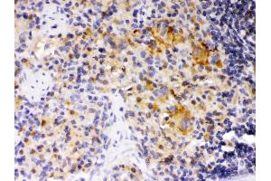 SKAP55 was detected in paraffin-embedded sections of rat spleen tissues using rabbit anti- SKAP55 Antigen Affinity purified polyclonal antibody at 1 μg/mL. (SKAP1 antibody  (Middle Region))