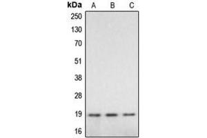 Western blot analysis of Caspase 2 p18 expression in HeLa (A), mouse liver (B), rat liver (C) whole cell lysates.