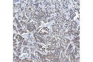 IHC analysis of PTGS2 using anti-PTGS2 antibody (ABIN7600352).