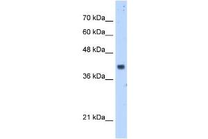 PDSS1 antibody used at 5 ug/ml to detect target protein. (PDSS1 antibody)