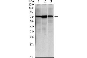 Western blot analysis using HSPA5 mouse mAb against NIH/3T3 (1), Hela (2) and Jurkat (3) cell lysate.