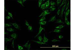 Immunofluorescence of monoclonal antibody to C21orf33 on HeLa cell. (C21orf33 antibody  (AA 188-268))