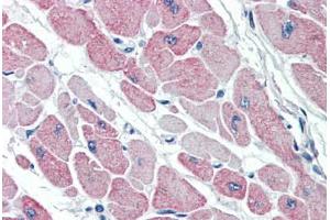Human Heart (formalin-fixed, paraffin-embedded) stained with CLIC4 antibody ABIN337111 at 5 ug/ml followed by biotinylated anti-goat IgG secondary antibody ABIN481715, alkaline phosphatase-streptavidin and chromogen. (CLIC4 antibody  (AA 8-20))