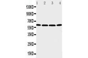Anti-P2X6 antibody, Western blotting Lane 1: U87 Cell Lysate Lane 2: 22RV1 Cell Lysate Lane 3: JURKAT Cell Lysate Lane 4:  Cell Lysate (P2RX6 antibody  (C-Term))